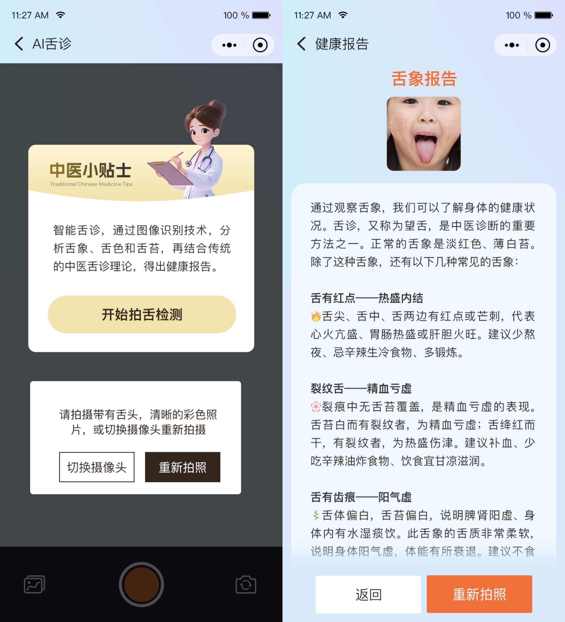 AI舌诊 AI舌诊